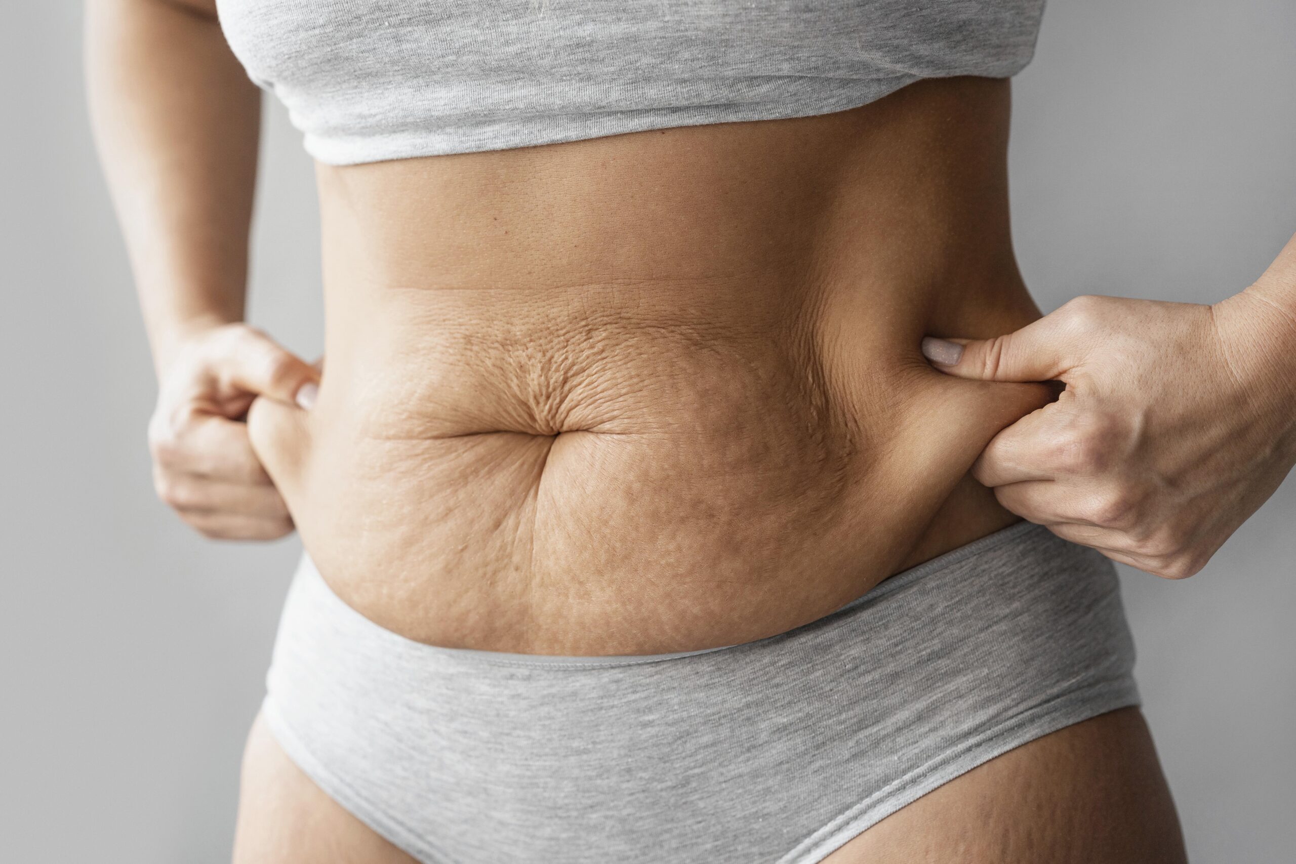 close-up-hands-holding-body-fat
