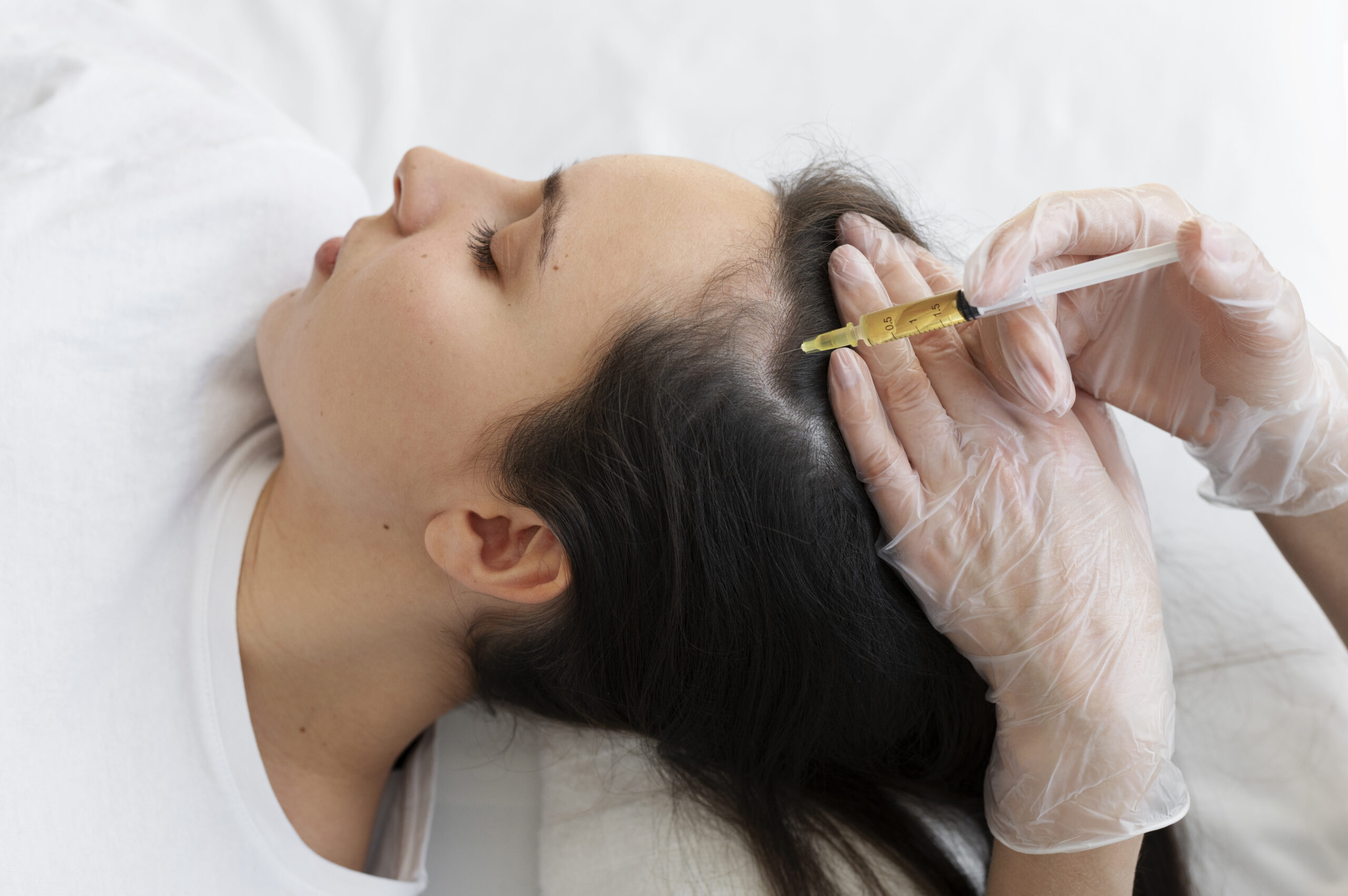 woman-getting-scalp-prp-treatment-high-angle