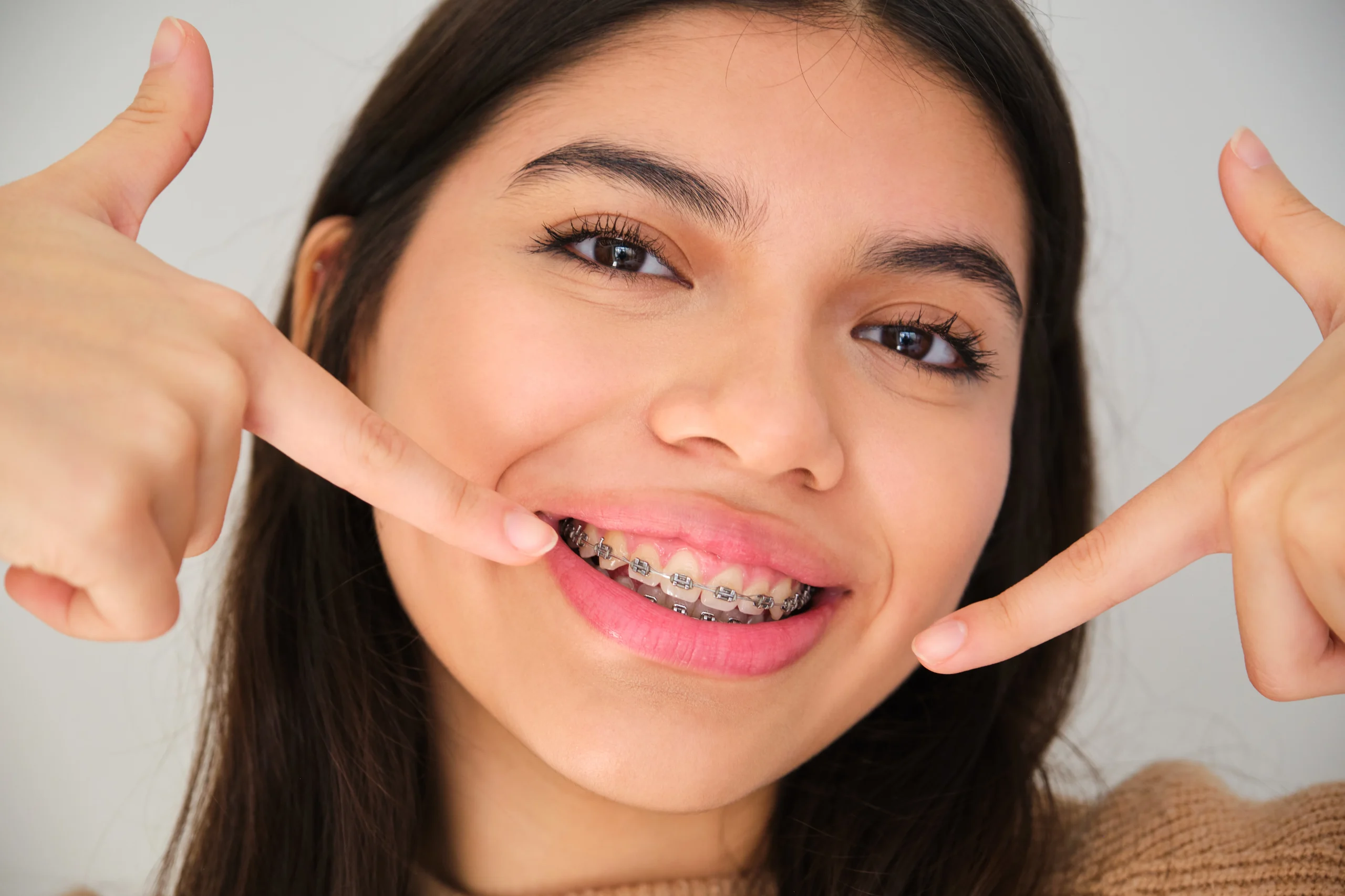 Braces treatment in Abu Dhabi