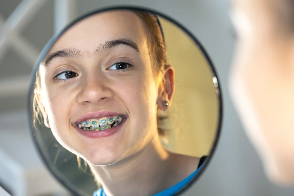 Braces treatment in Abu Dhabi